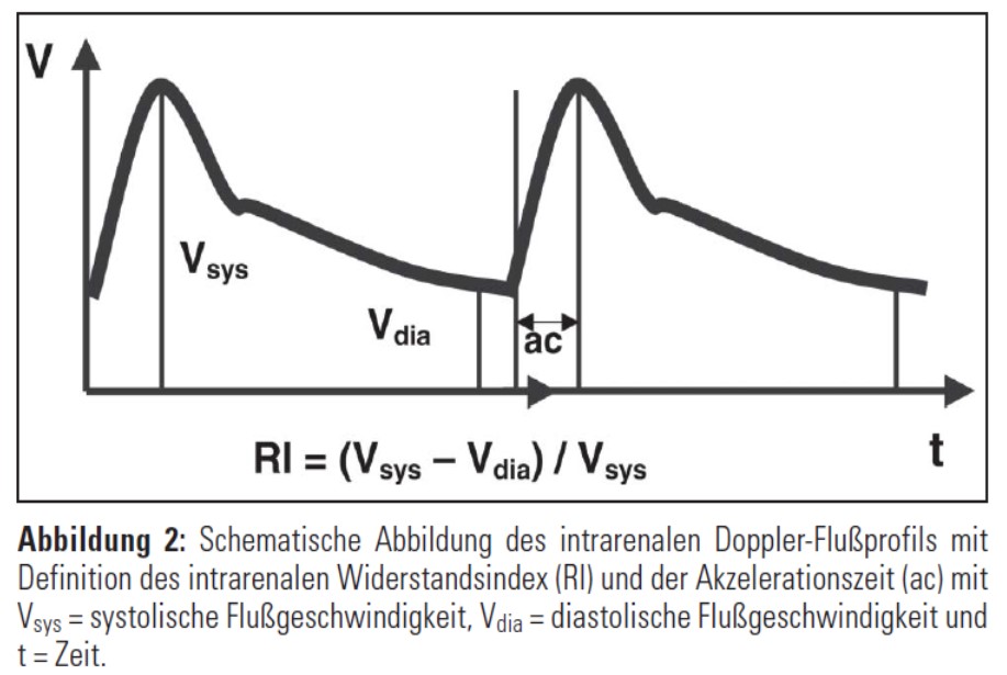 Akkzelerationszeit